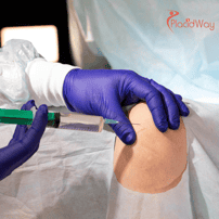 Stem Cell Therapy for Cartilage Regeneration in Mexico: A Cost-Effective Solution for Canadians